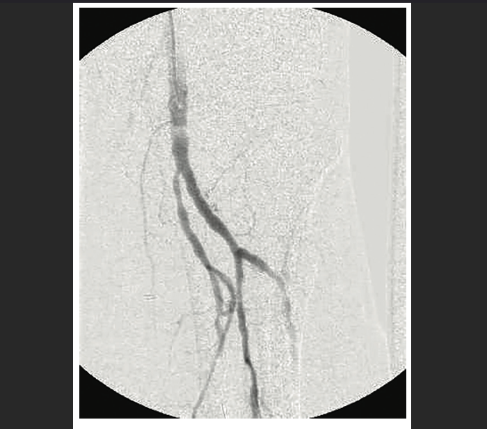 Modified CART Technique How to Maximize the Efficiency of CART and